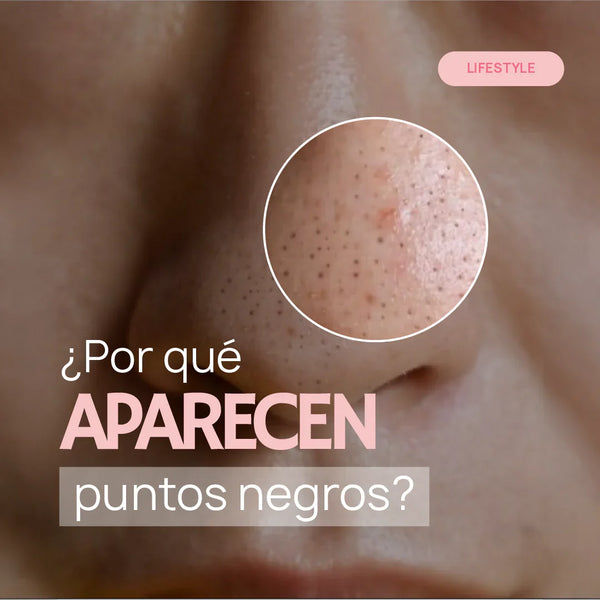 ¿Por qué aparecen puntos negros? Cómo eliminarlos y mejorar la apariencia de tu piel con el Tónico Anti Imperfecciones