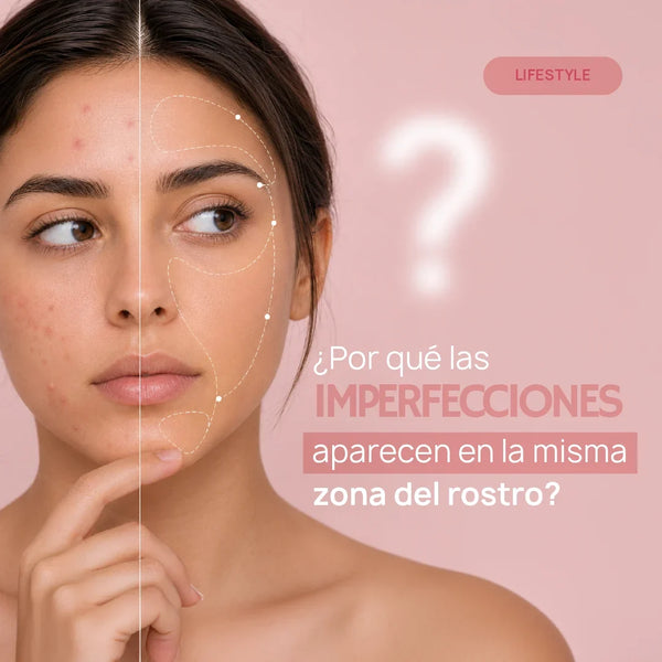 ¿Por qué las imperfecciones aparecen siempre en la misma zona del rostro?