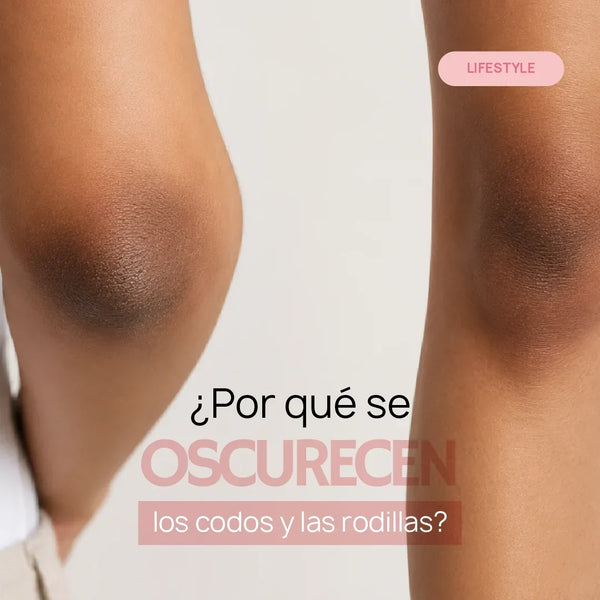 ¿Por qué se oscurecen los codos y las rodillas? Hábitos que pueden empeorar su apariencia