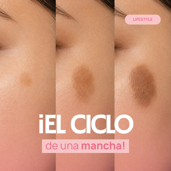 ¡El ciclo de una mancha! Desde la inflamación hasta la recuperación del tono