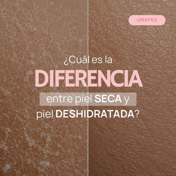 ¿Cuál es la diferencia entre piel seca y piel deshidratada? Guía completa para entender tu piel y la importancia del sérum de ácido hialurónico