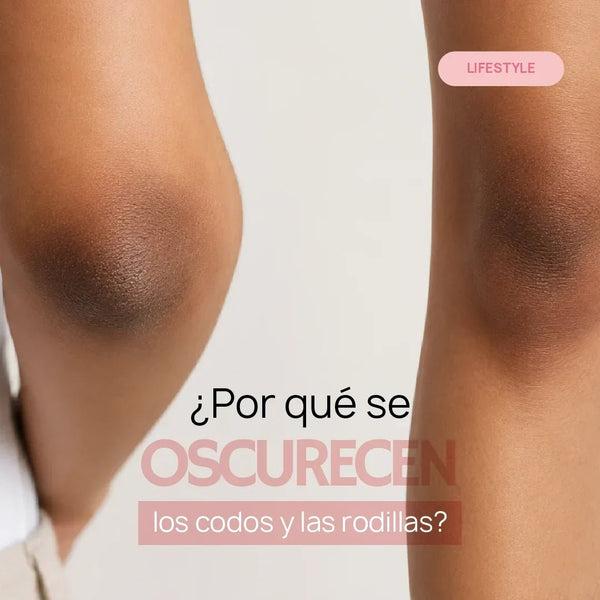 ¿Por qué se oscurecen los codos y las rodillas? Hábitos que pueden empeorar su apariencia